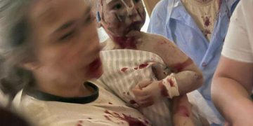 Pamje tronditëse në Kiev, pas sulmit Rus me raketa ndaj spitalit të fëmijëve: Shumë njerëz ende nën rrënoja